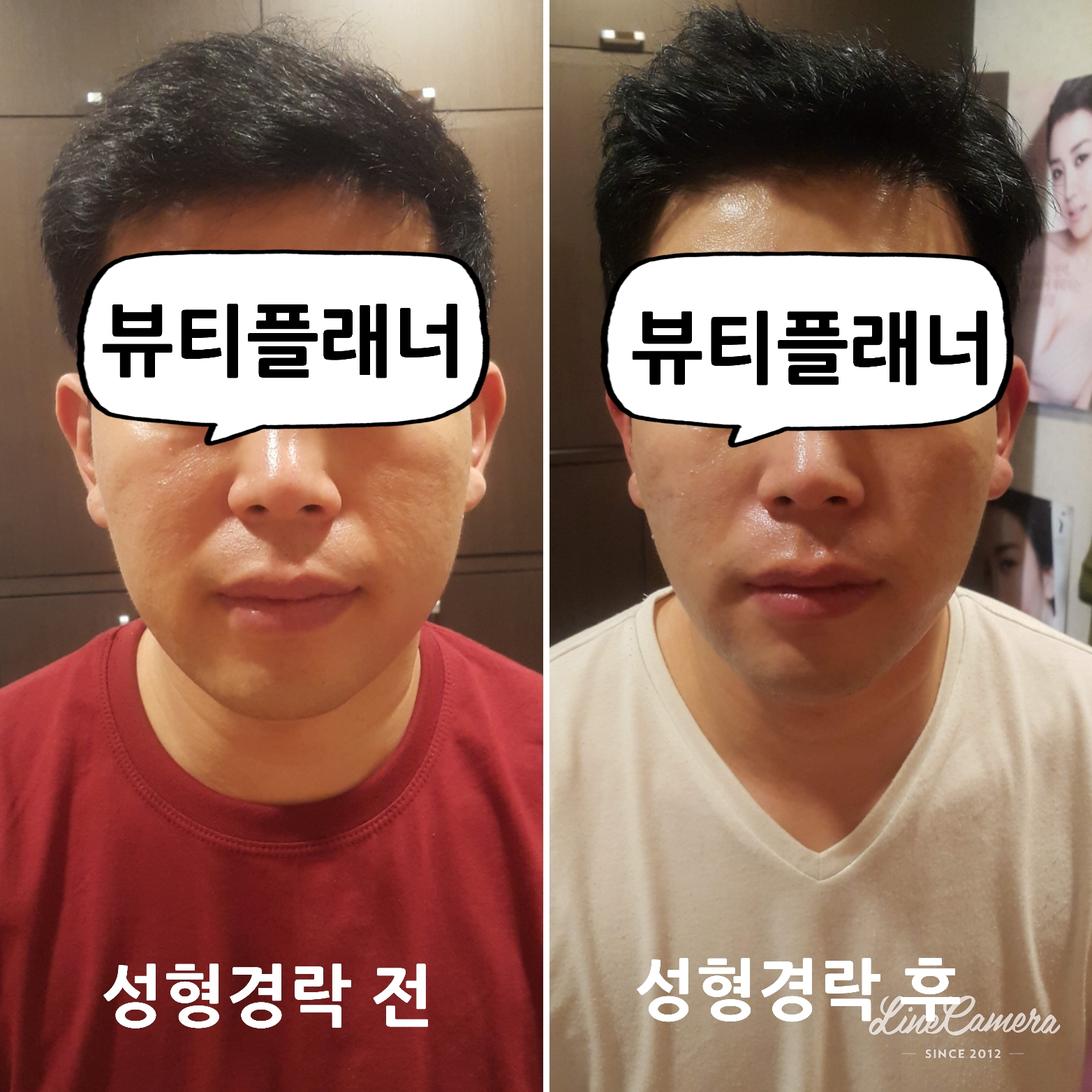 뷰티플래너 용호점 얼굴경락 photo 4