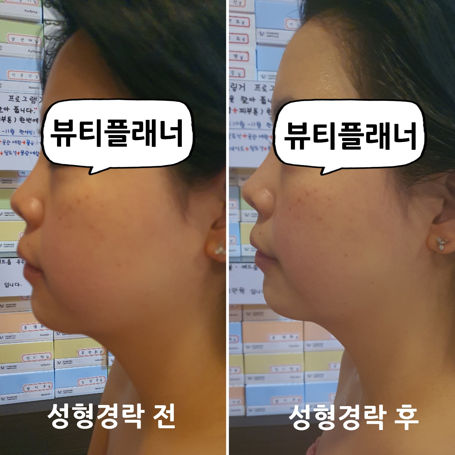 뷰티플래너 용호점 얼굴경락 photo 3