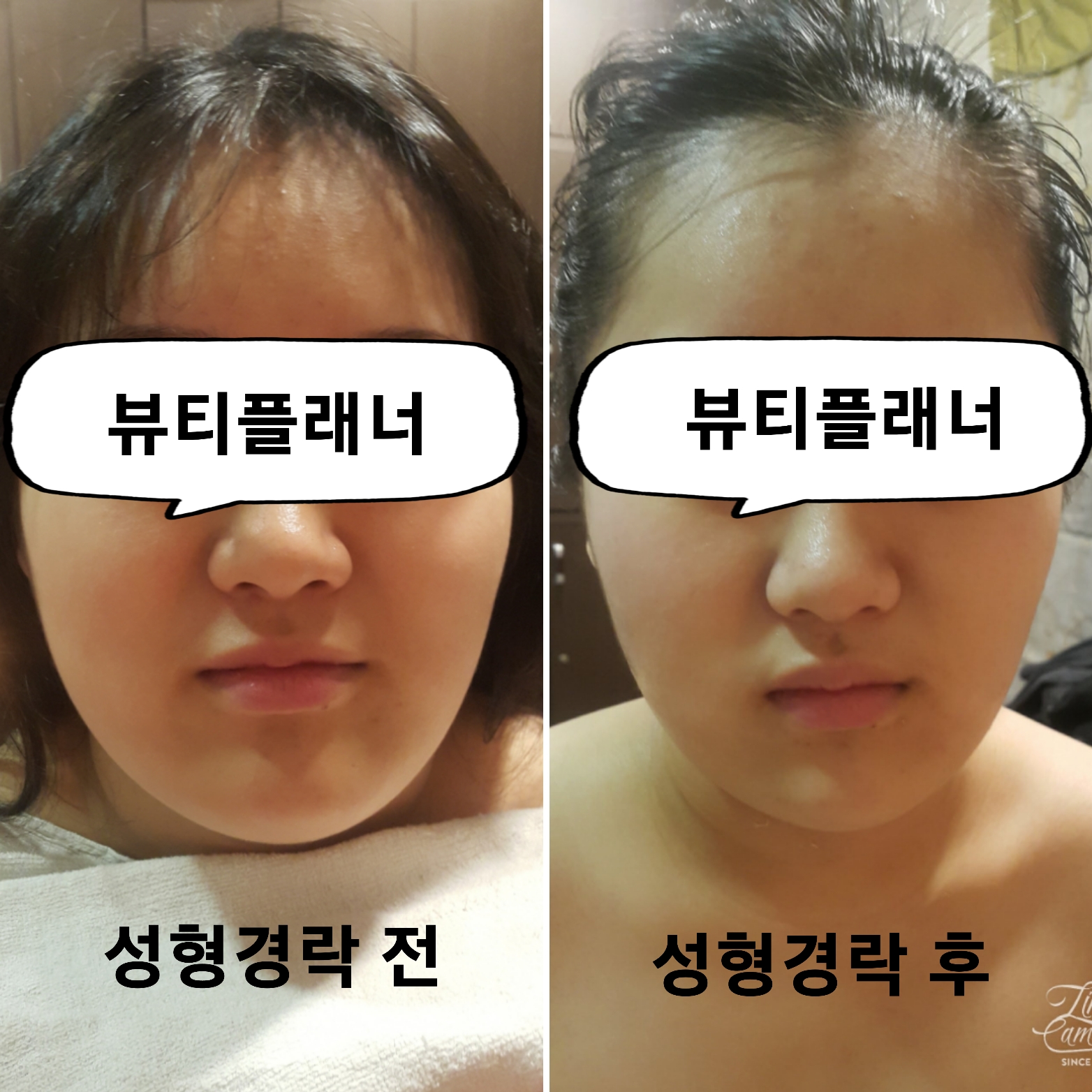 뷰티플래너 용호점 얼굴경락 photo 8