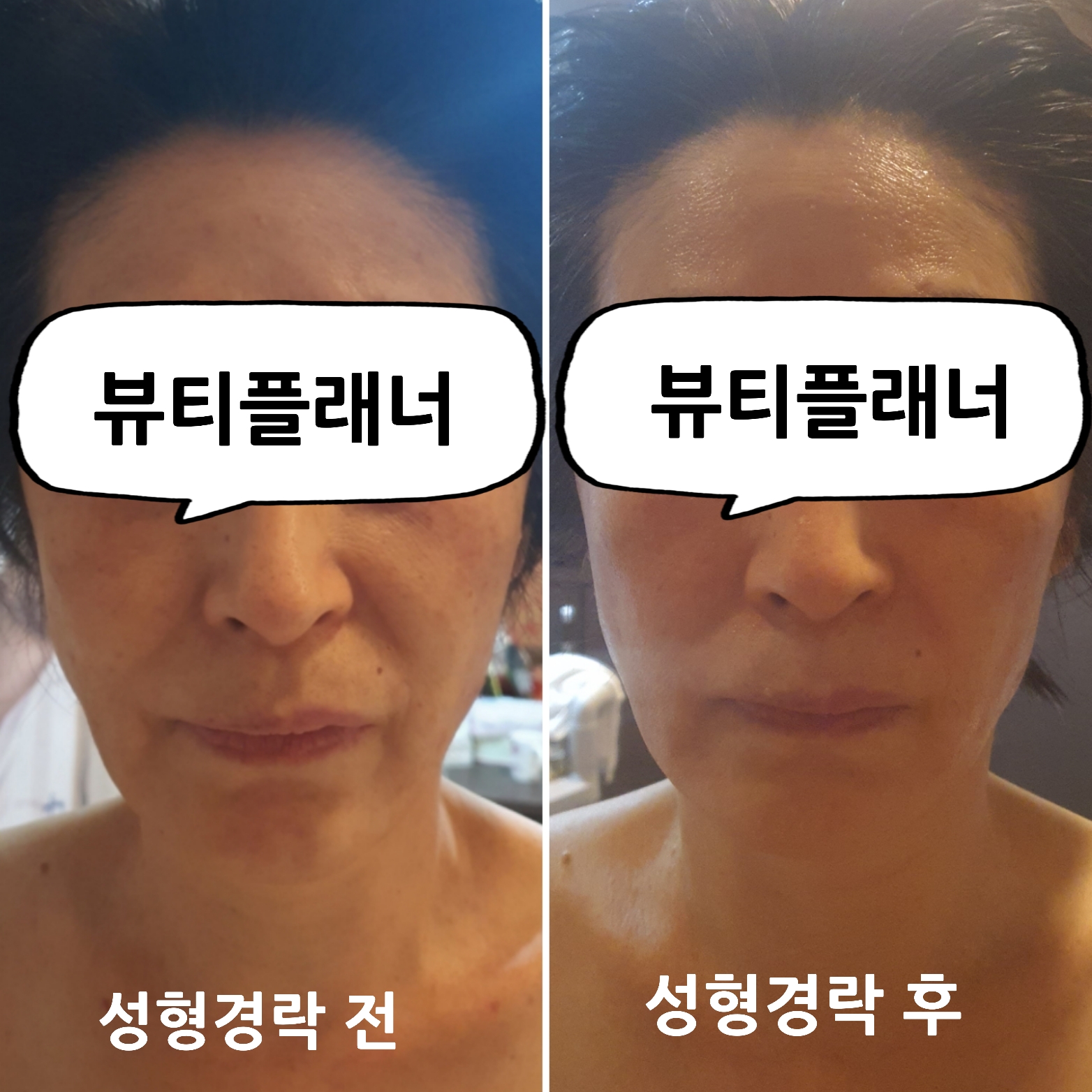 뷰티플래너 용호점 얼굴경락 대표 이미지