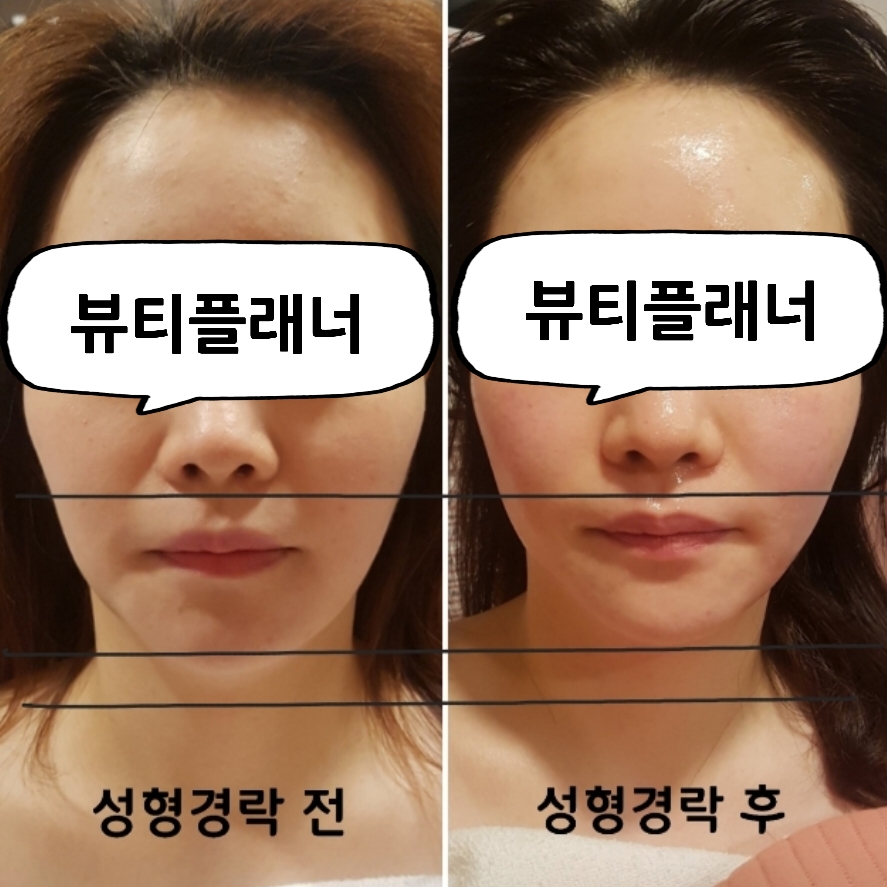 뷰티플래너 용호점 얼굴경락 photo 7