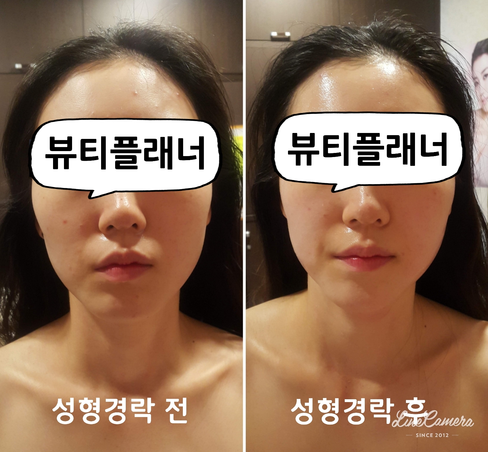 뷰티플래너 용호점 얼굴경락 photo 2