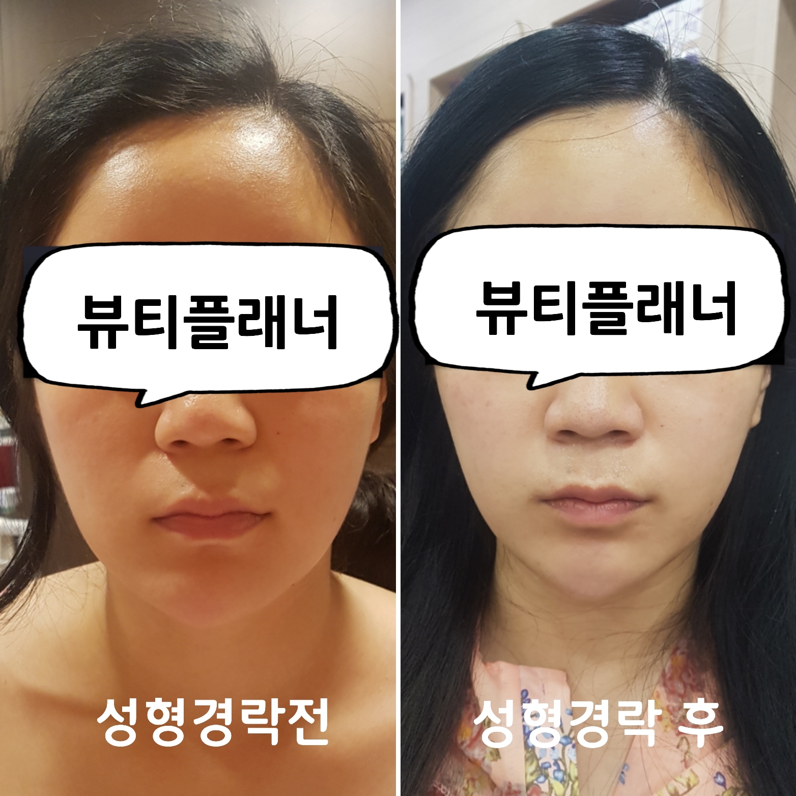 뷰티플래너 용호점 얼굴경락 photo 9
