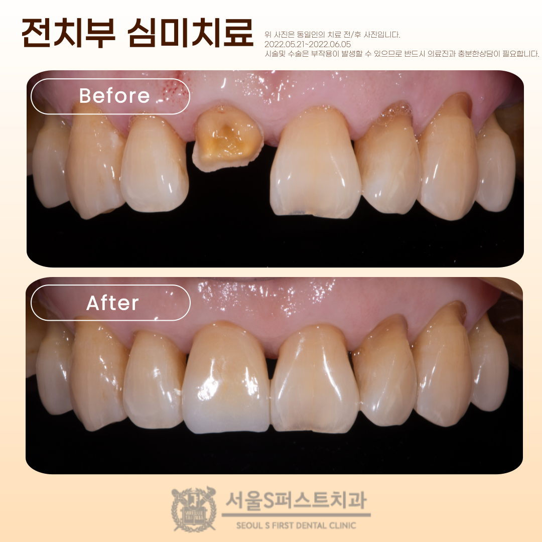 서울에스퍼스트치과의원 성남 대표 이미지