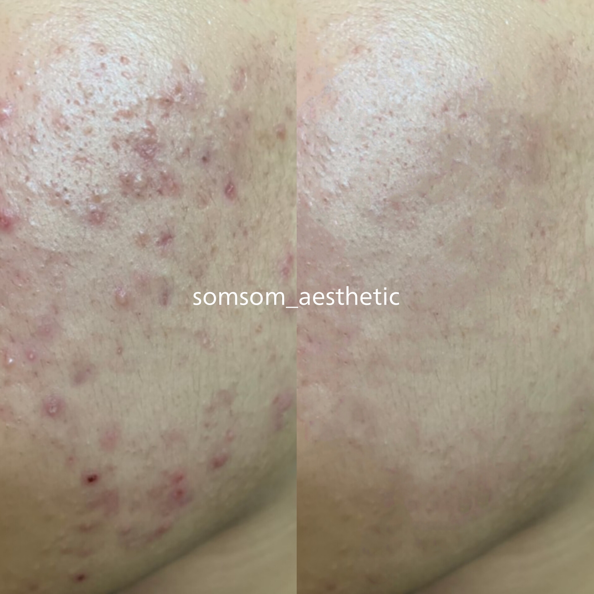 솜솜에스테틱 강남 선릉본점 대표 이미지