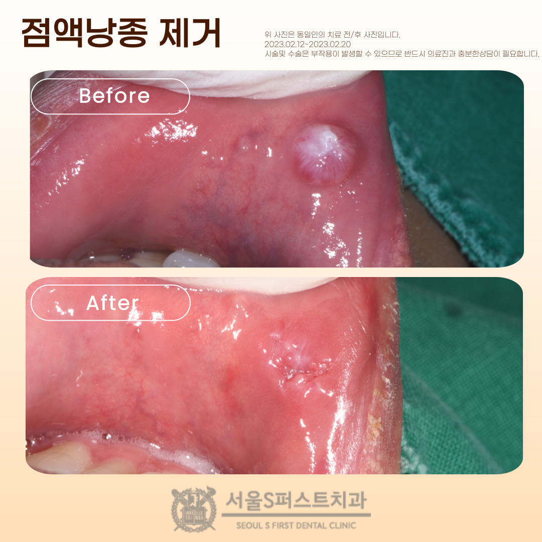 서울에스퍼스트치과의원 성남 대표 이미지