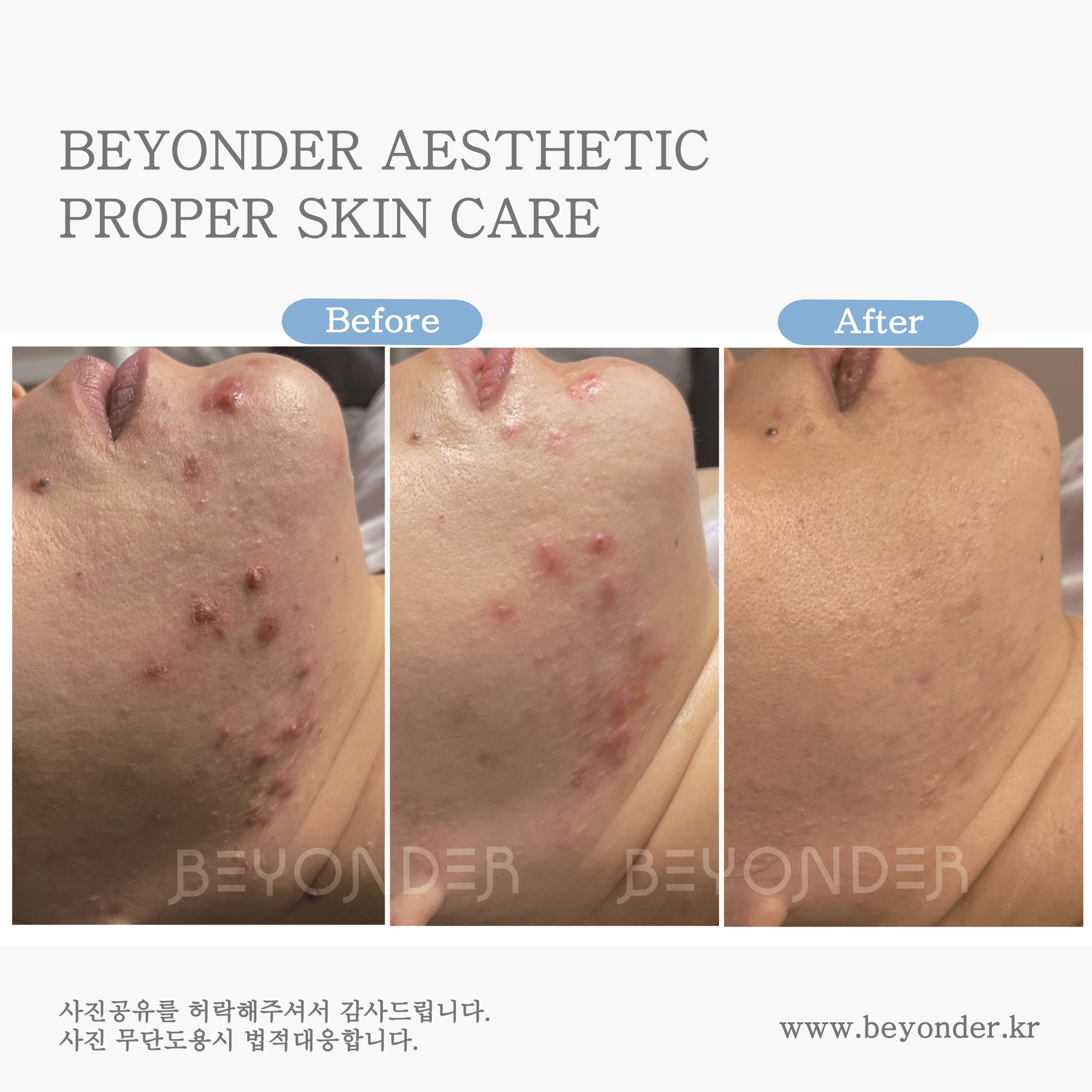 비욘더 대표 이미지