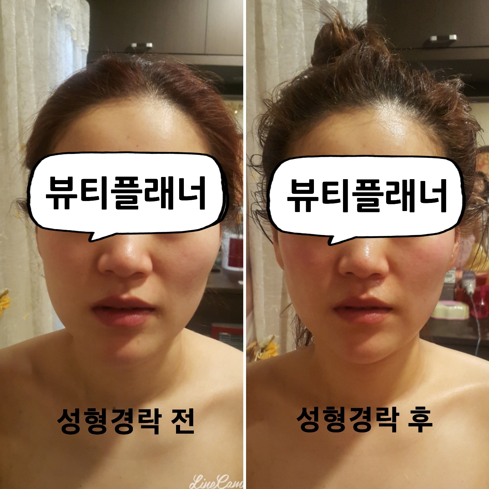 뷰티플래너 용호점 얼굴경락 photo 6
