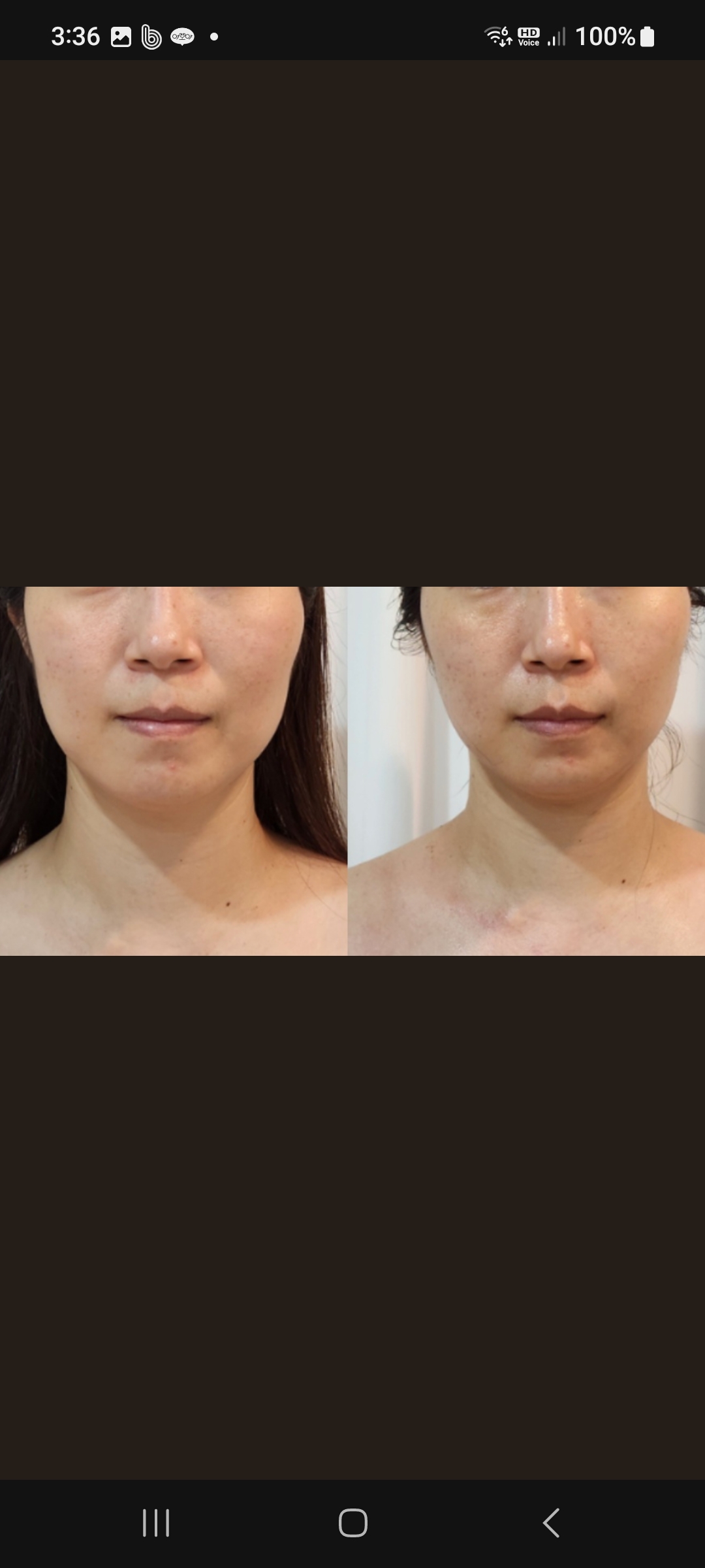 예쁨토탈뷰티샵 photo 10
