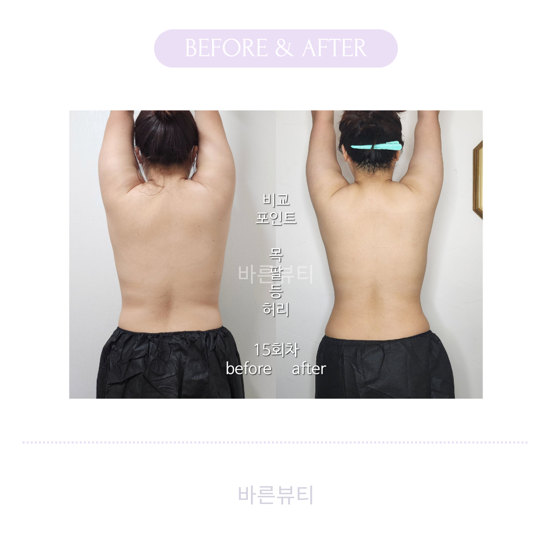 바른뷰티 photo 3