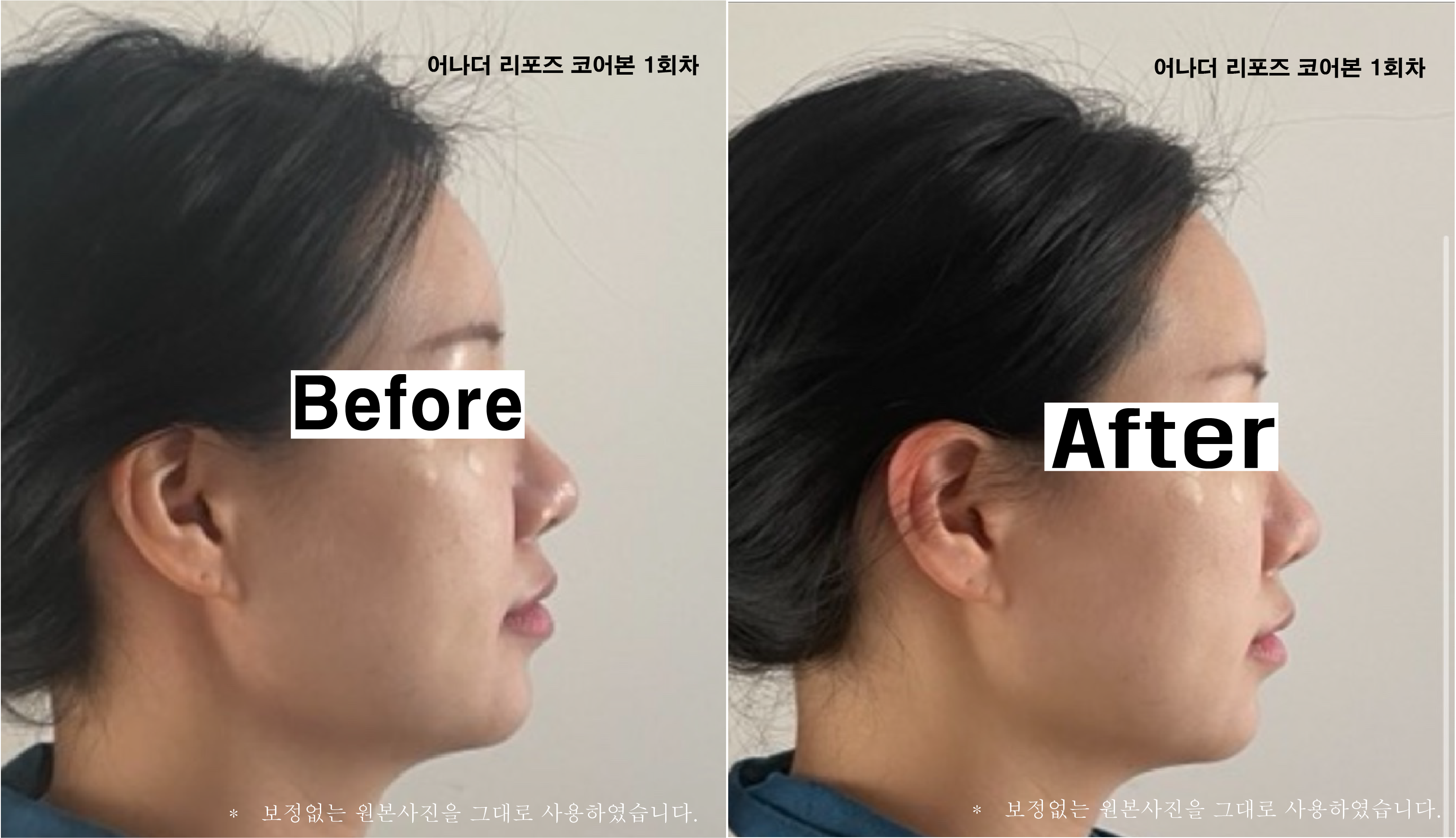 어나더근본 천안본점