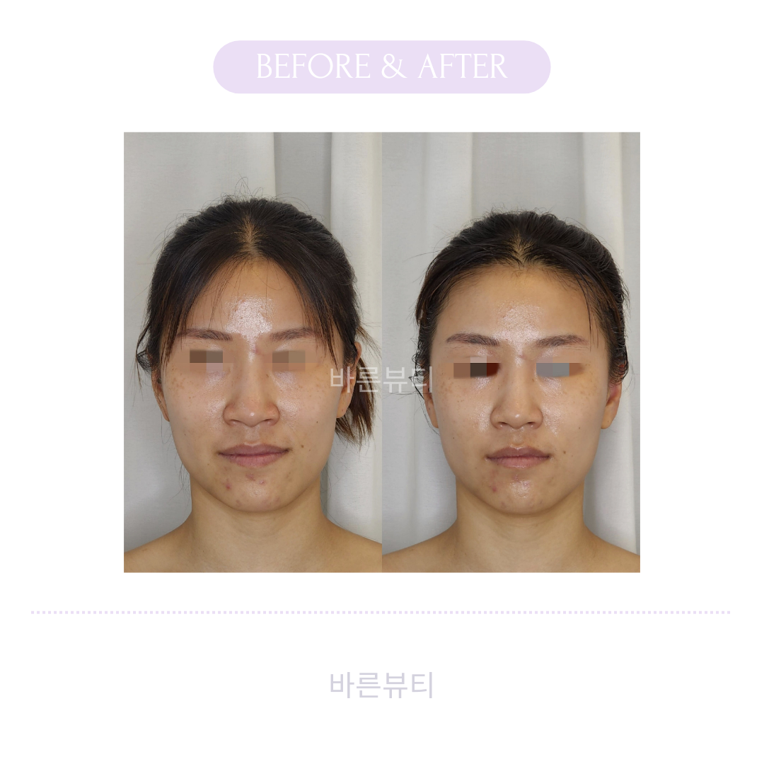 바른뷰티 photo 7