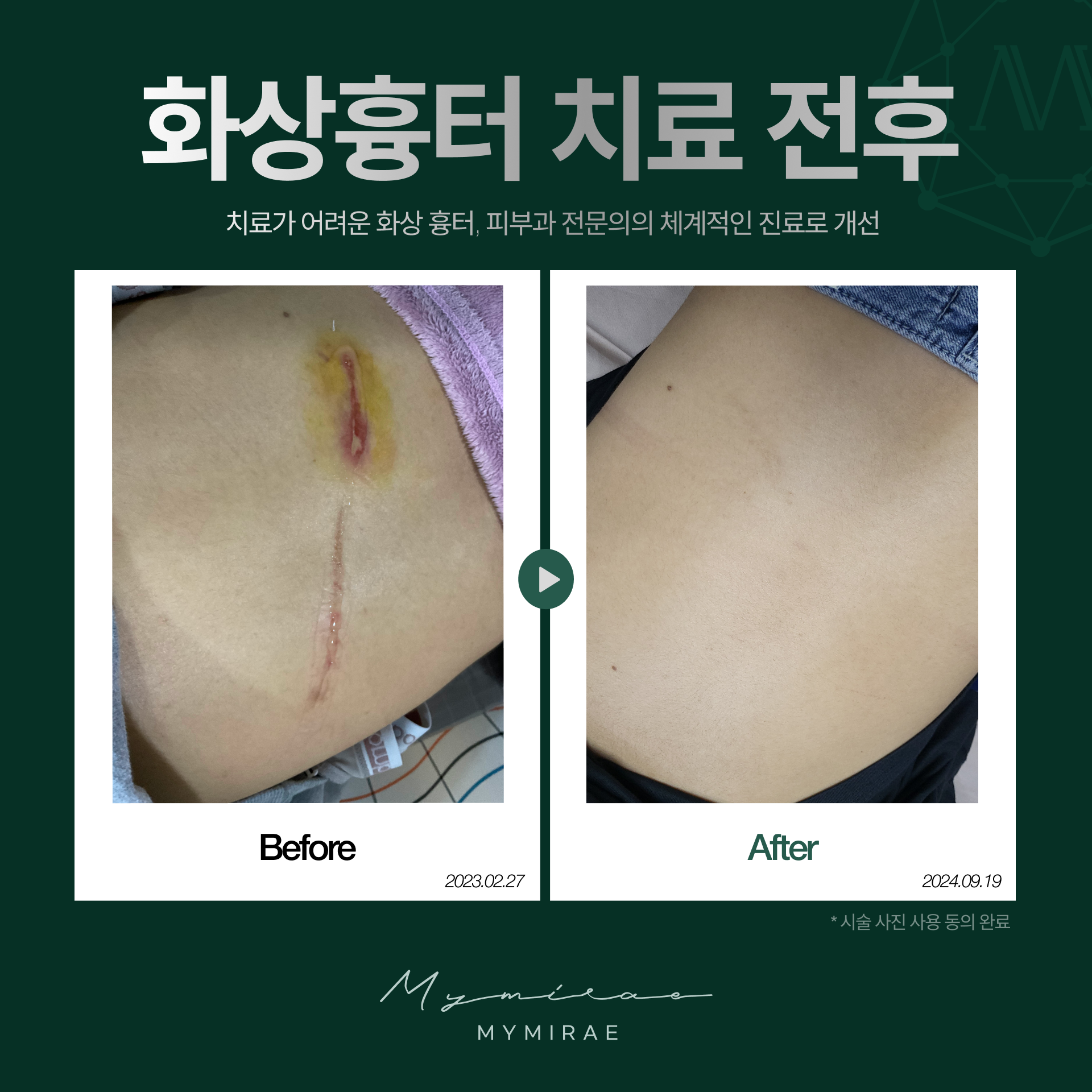 나의미래피부과의원
