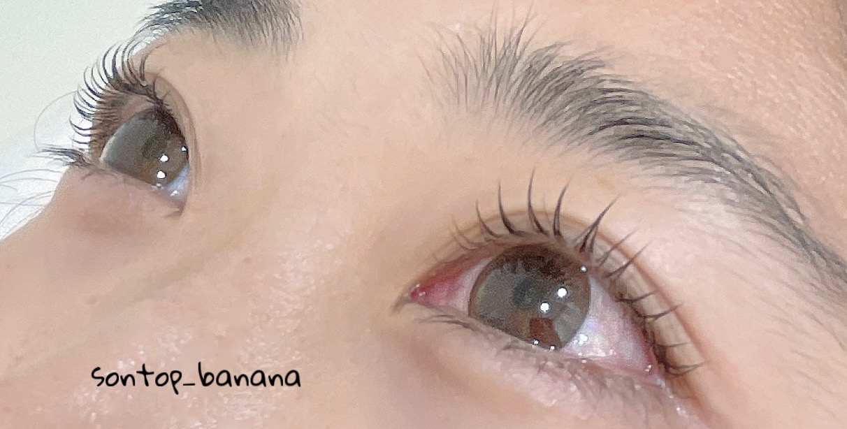 손톱에바나나 대표 이미지