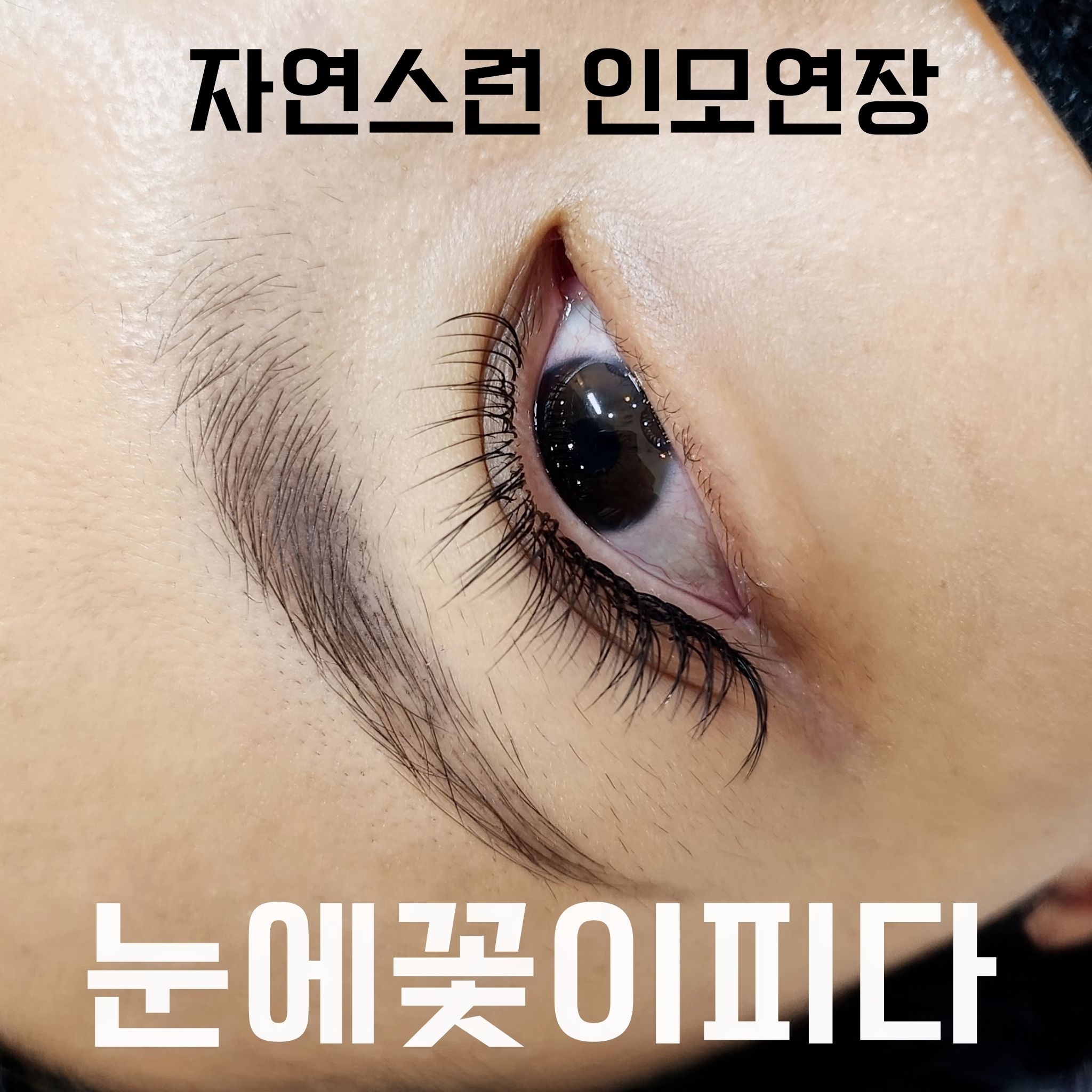 눈에꽃이피다
