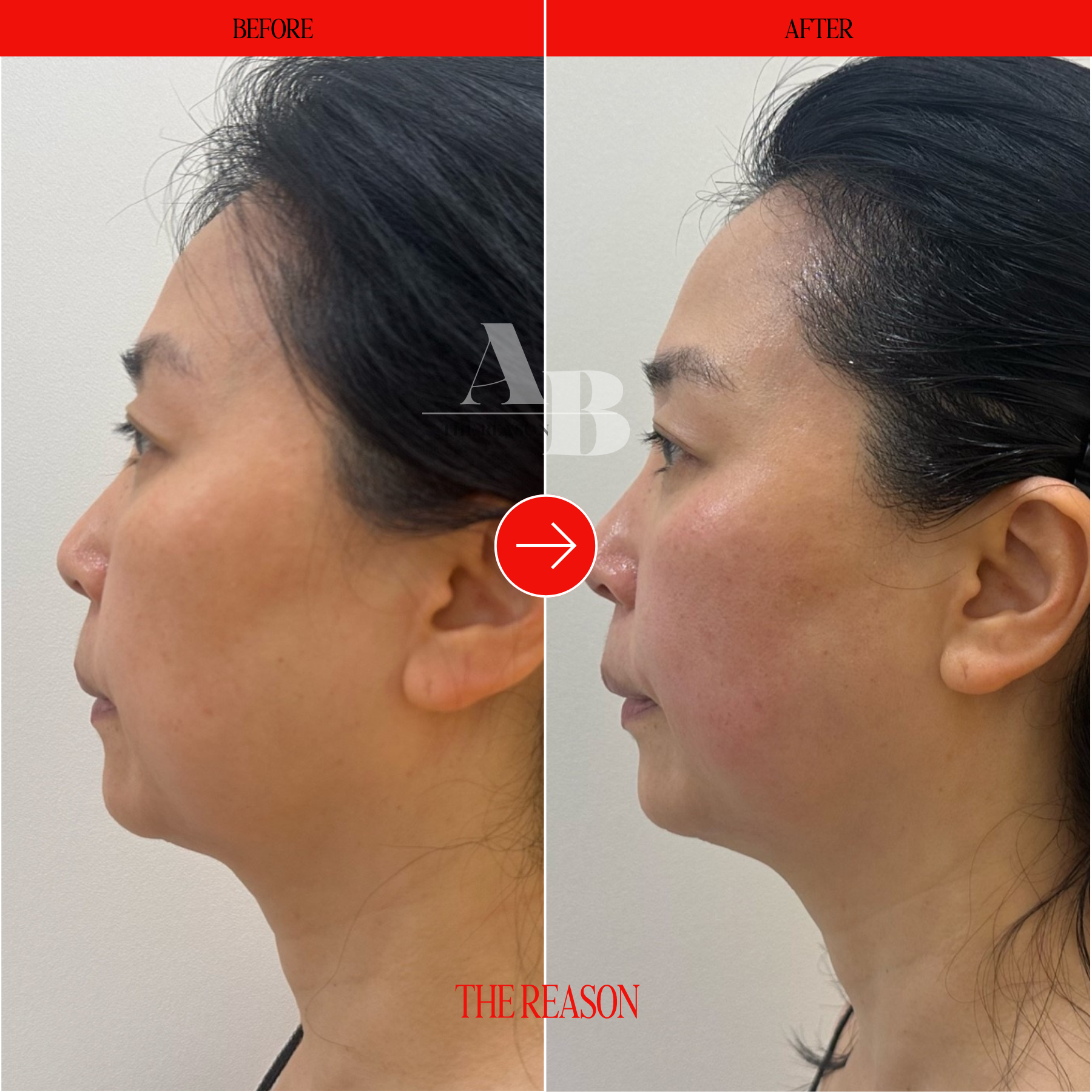 더리즌 대표 이미지