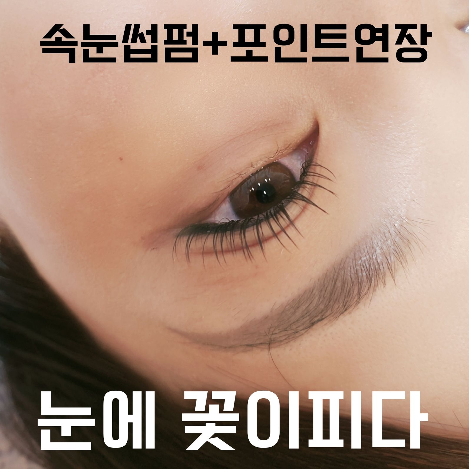눈에꽃이피다