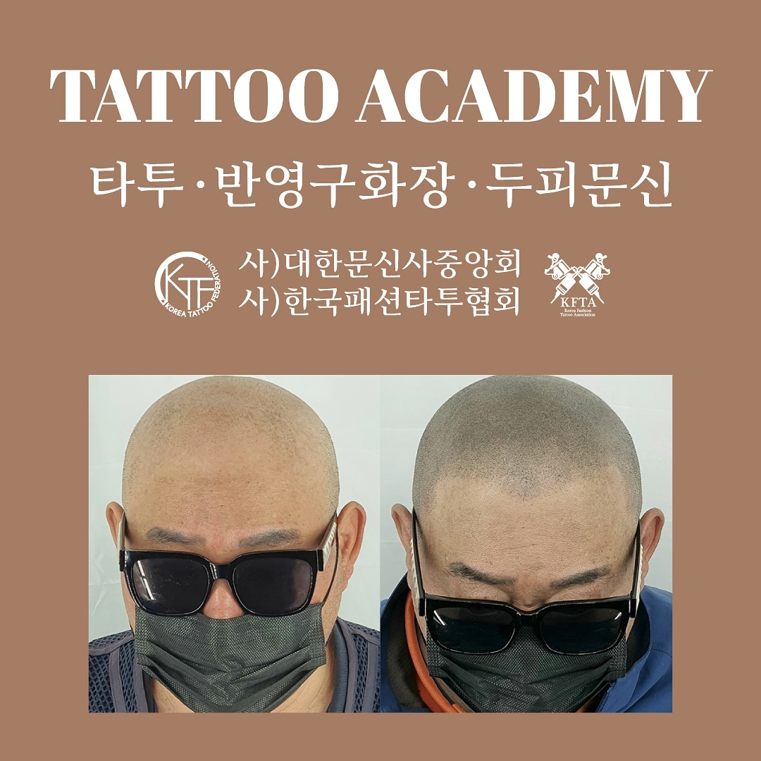 에스지스칼프