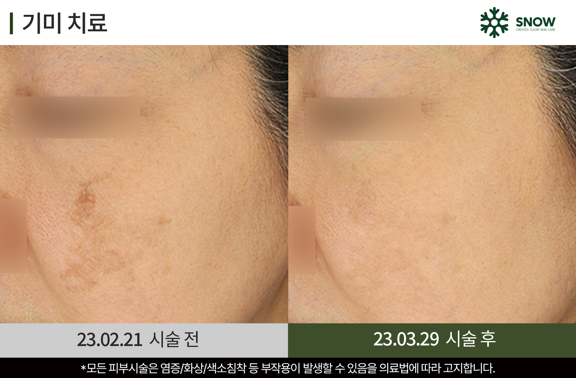 스노우의원 대전둔산점