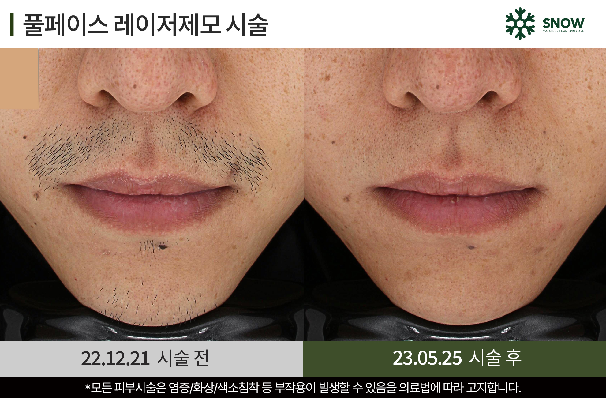 스노우의원 대전둔산점