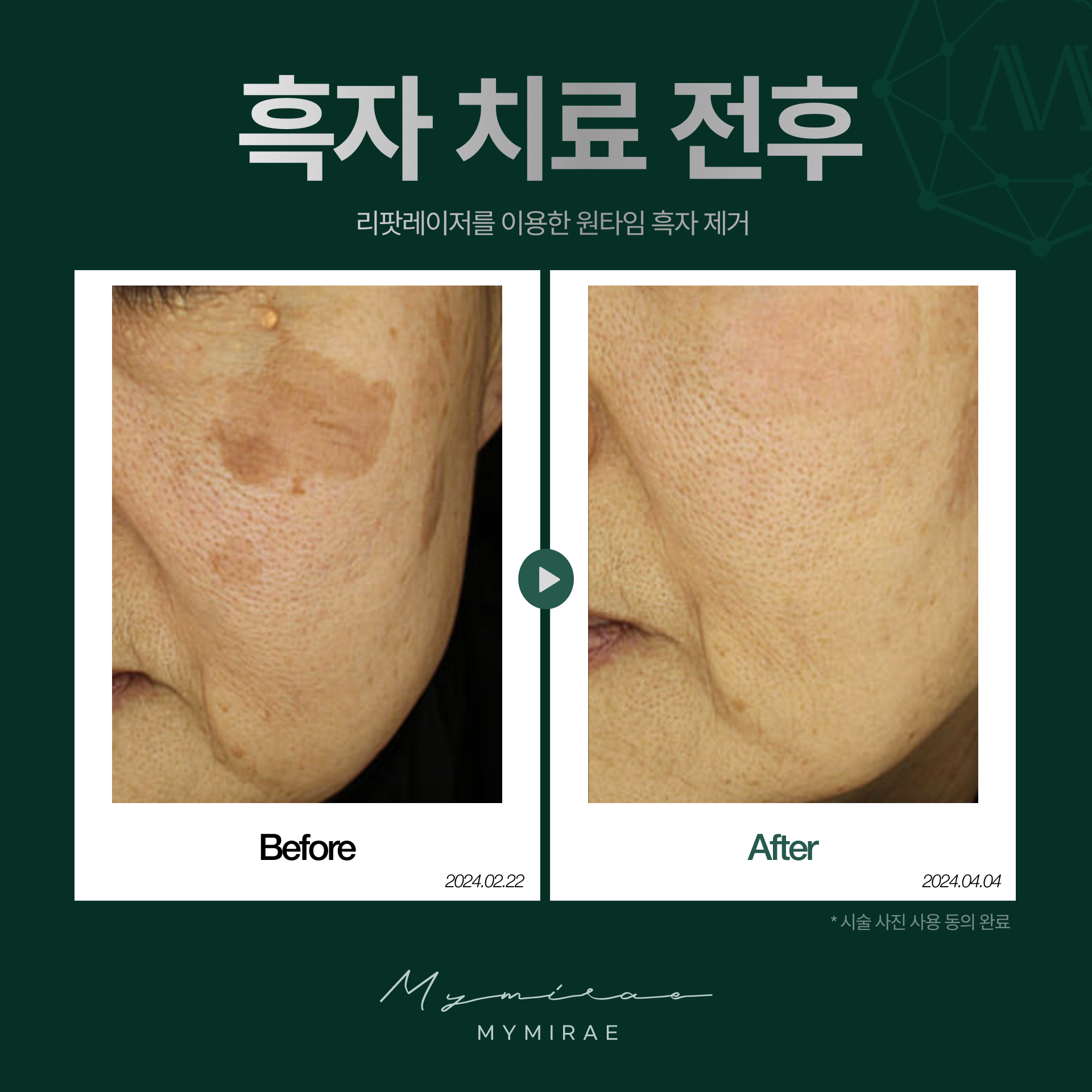 나의미래피부과의원