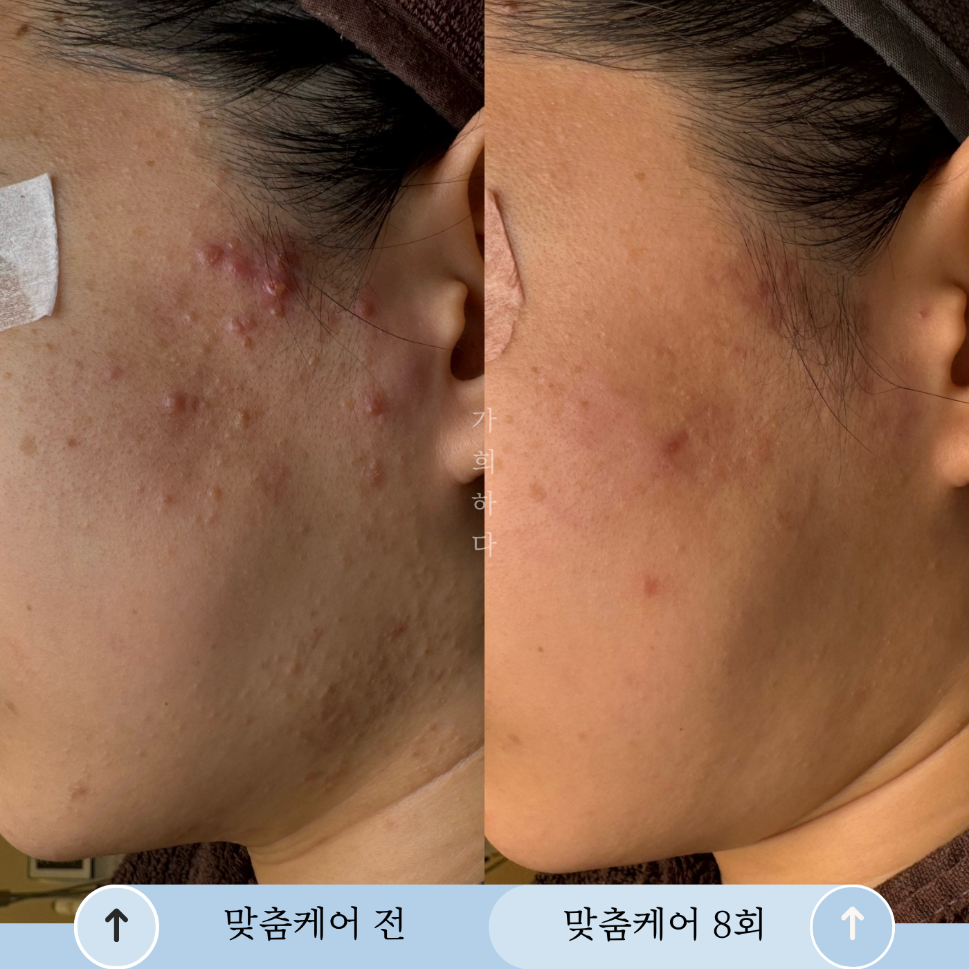 가희하다 잠실 대표 이미지