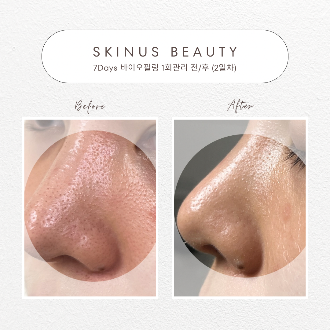 스킨어스뷰티 용인본점 대표 이미지