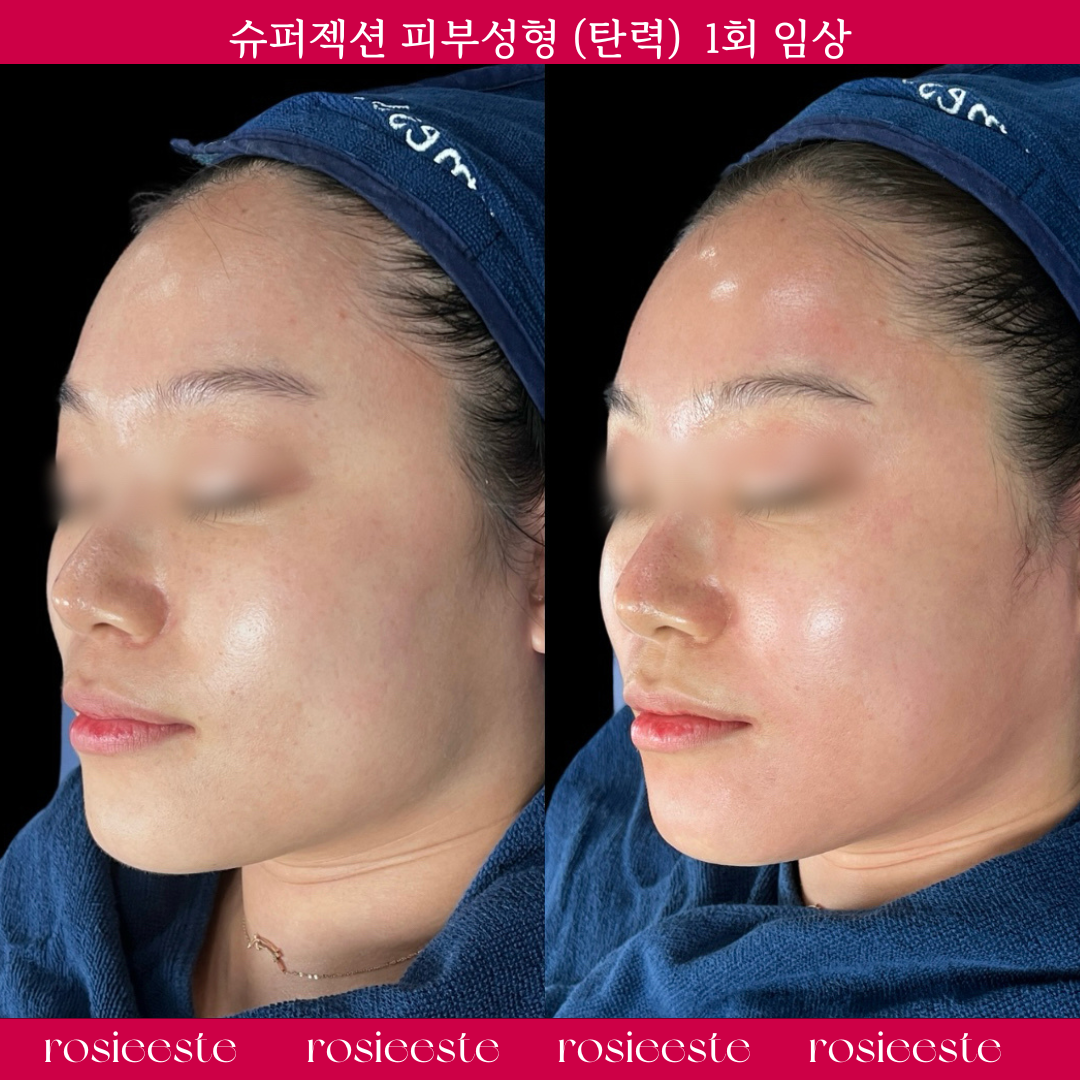 로지에스떼 대표 이미지