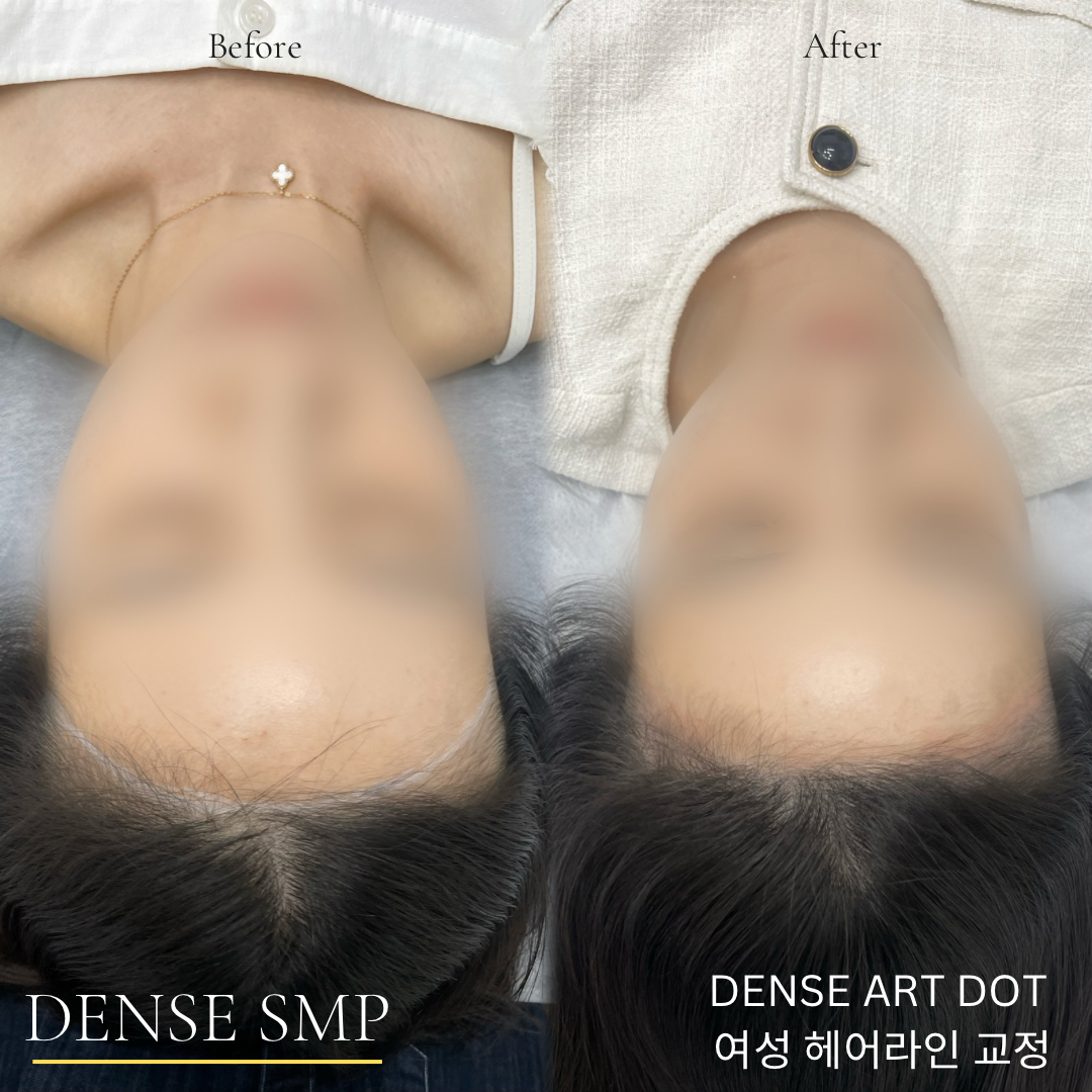 덴스 닷 뷰티 대표 이미지