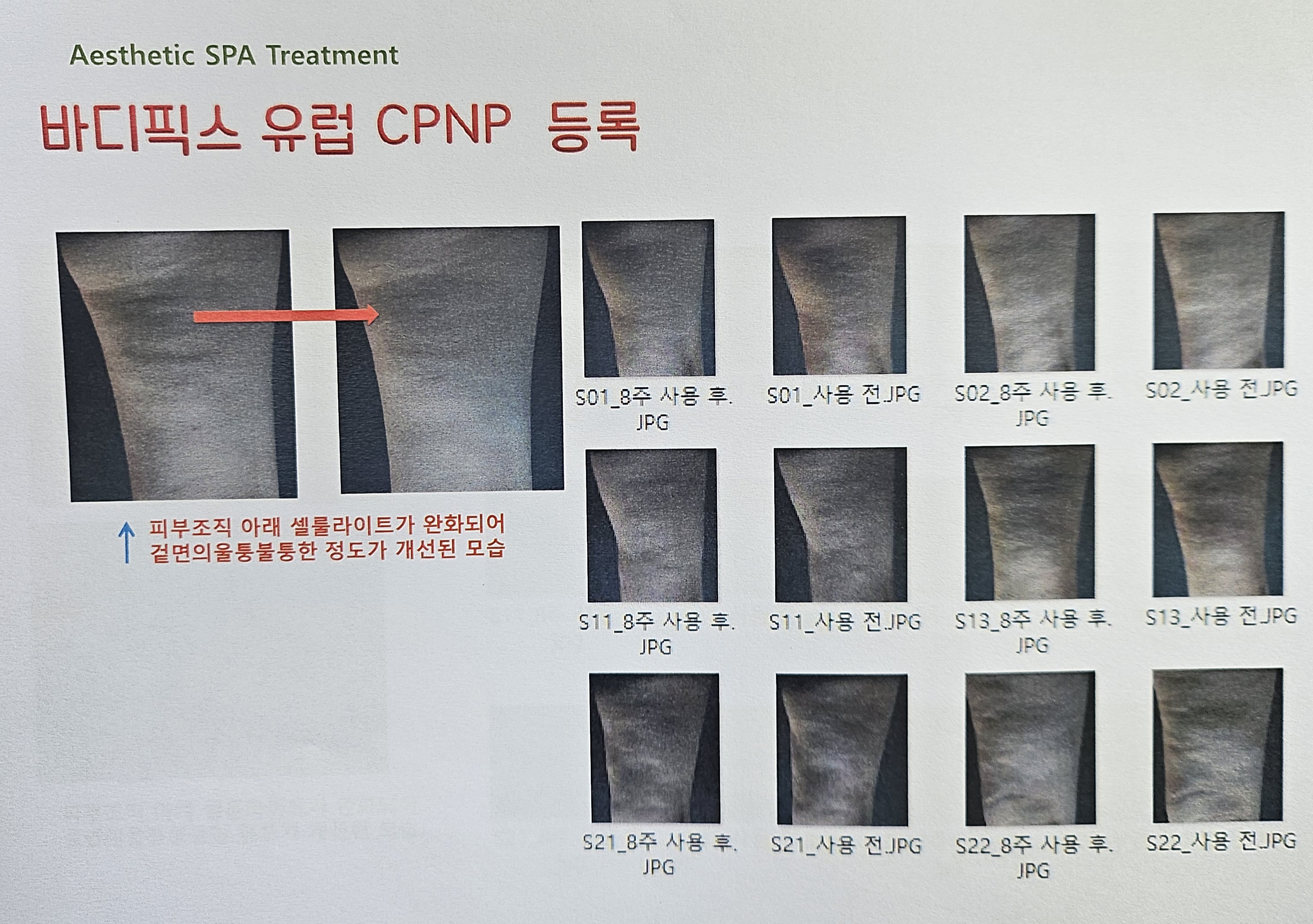 스킨톡에스테틱