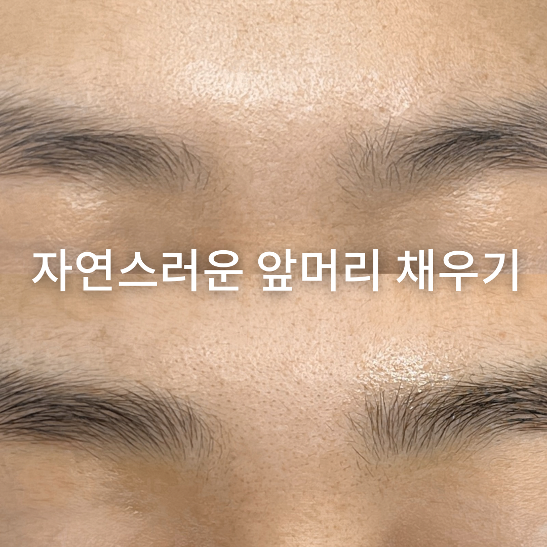 아르떼스칼프