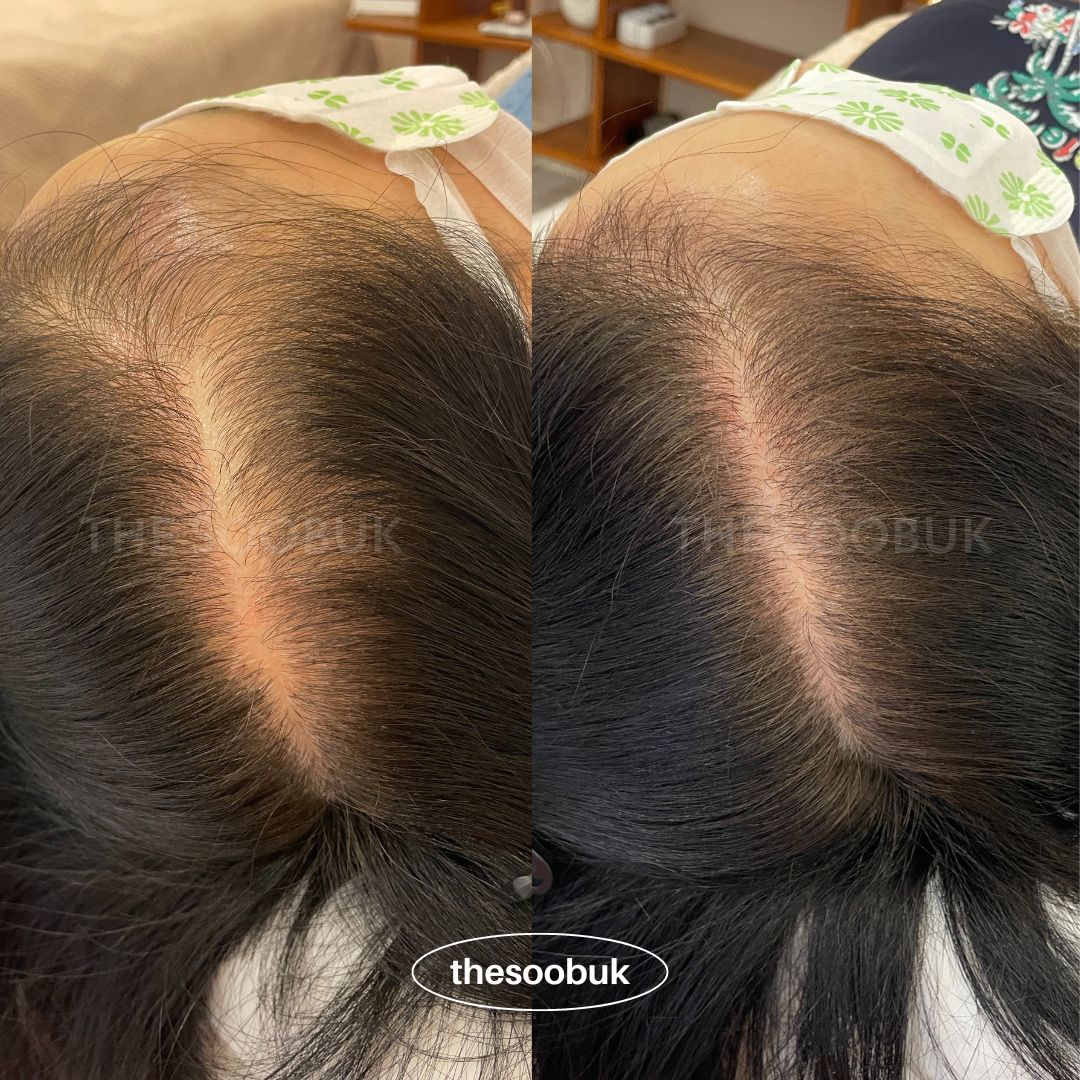 컬러인스킨 부평본점 대표 이미지