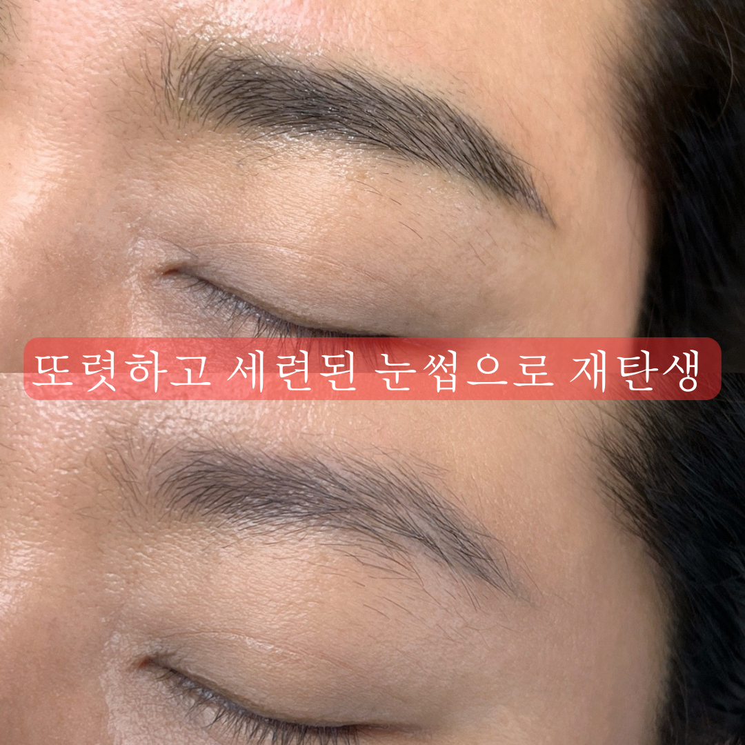 아르떼스칼프