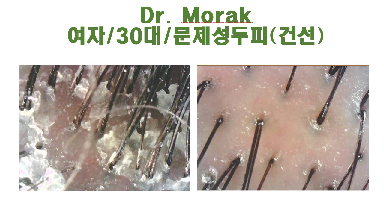 닥터모락 강남점 대표 이미지