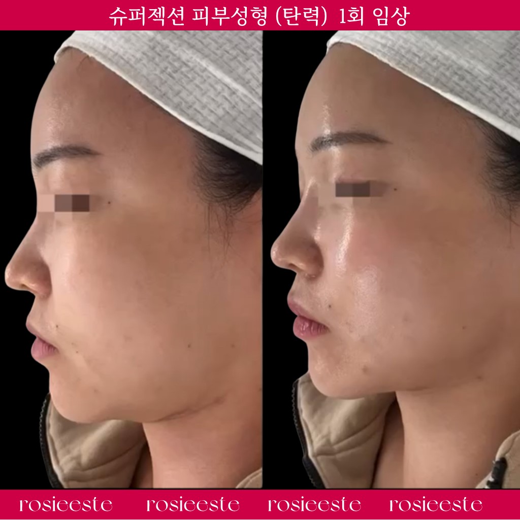 로지에스떼 서초 잠원본점 대표 이미지