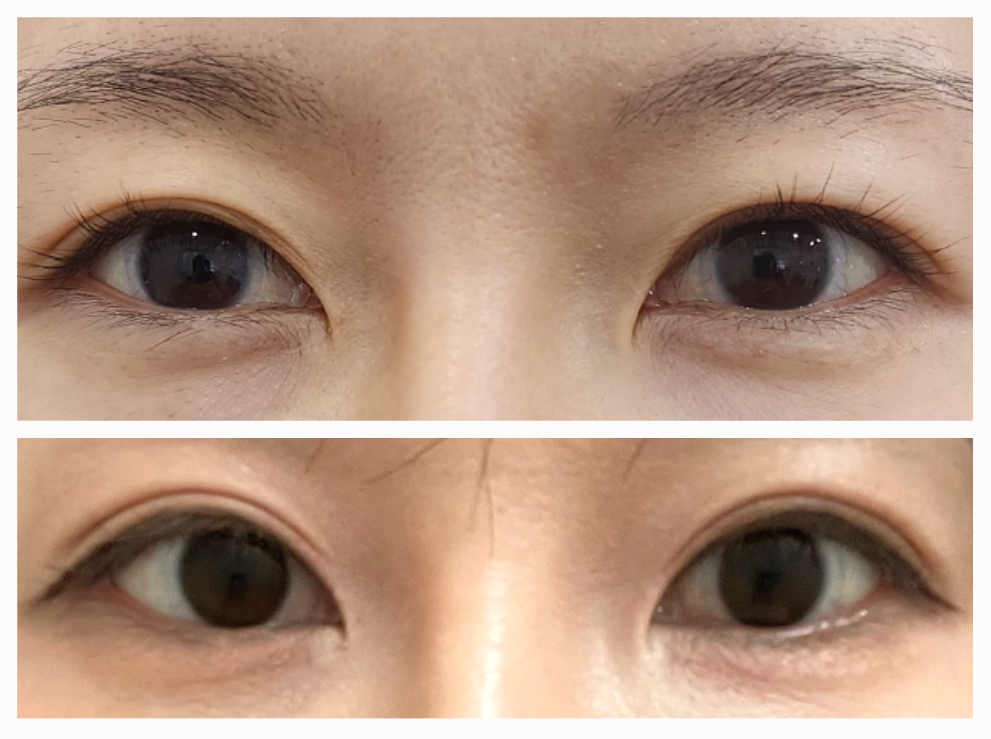 뷰티쏠대곡점 플라즈마블라스트
