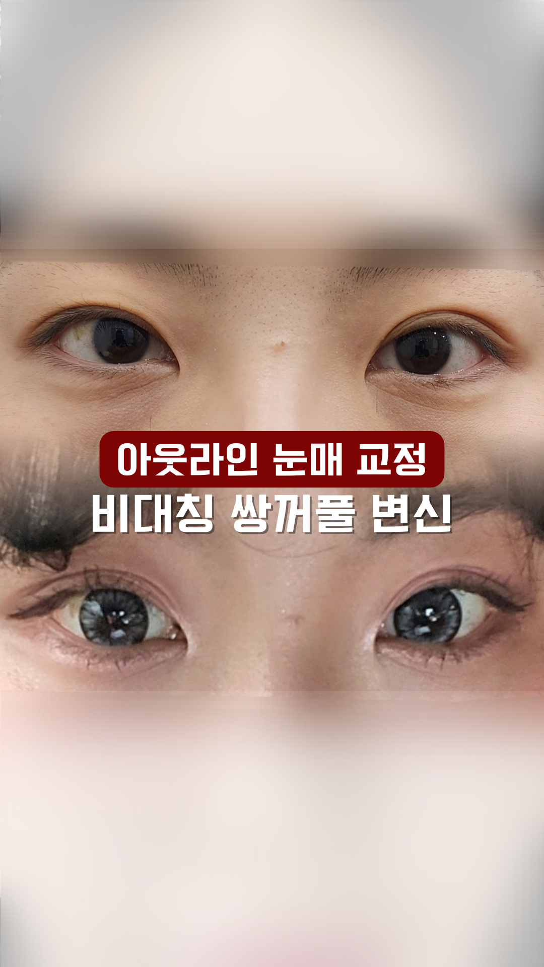 뷰티쏠대곡점 플라즈마블라스트