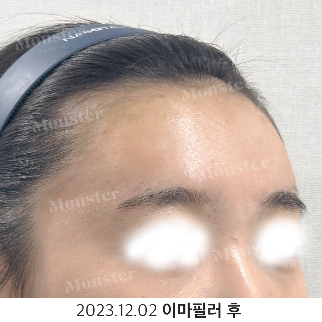몬스터의원