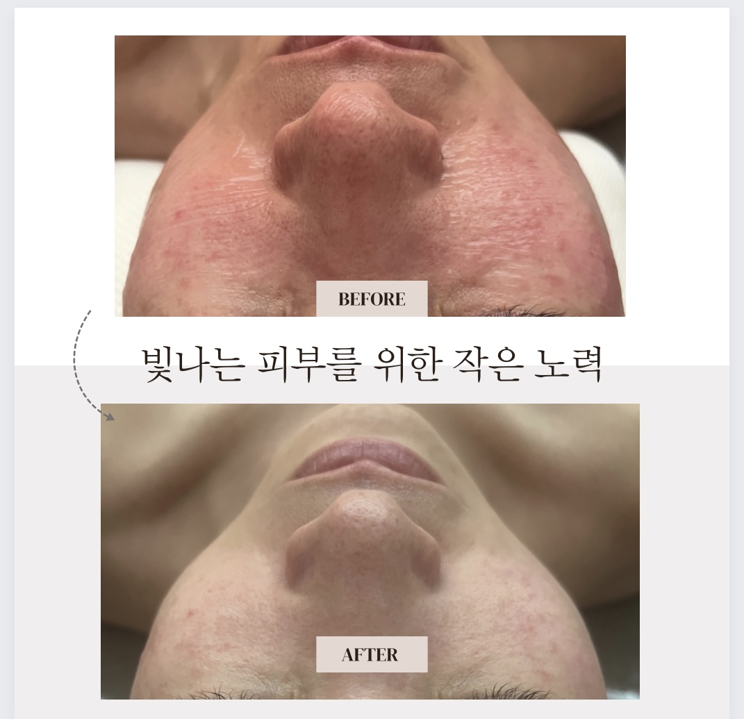 더예쁜날