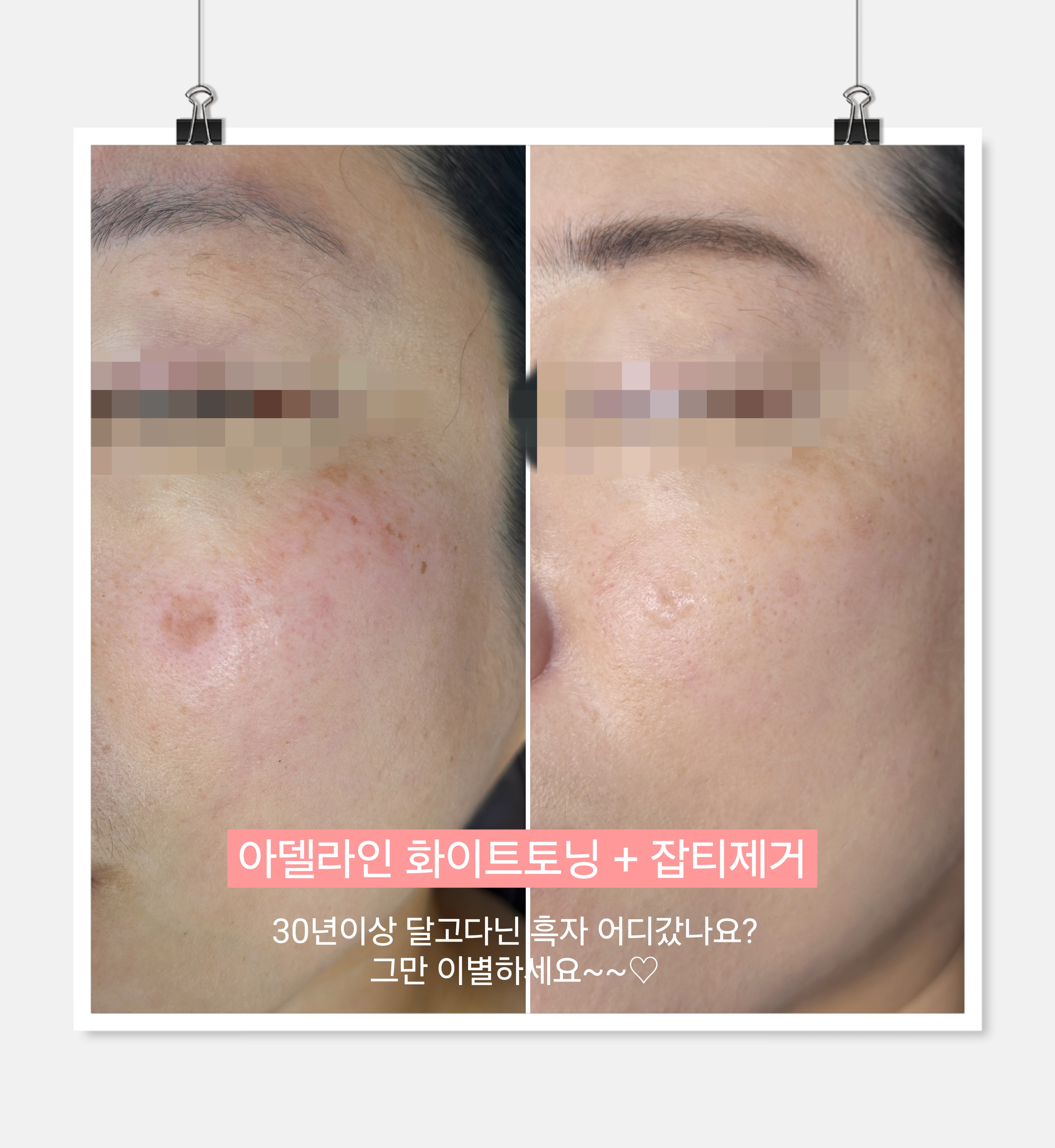 아델라인 뷰티&바디테라피
