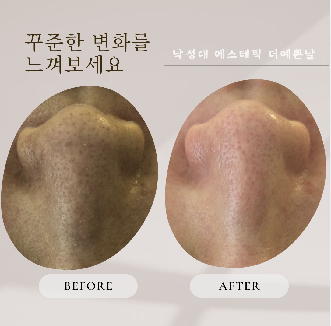 더예쁜날