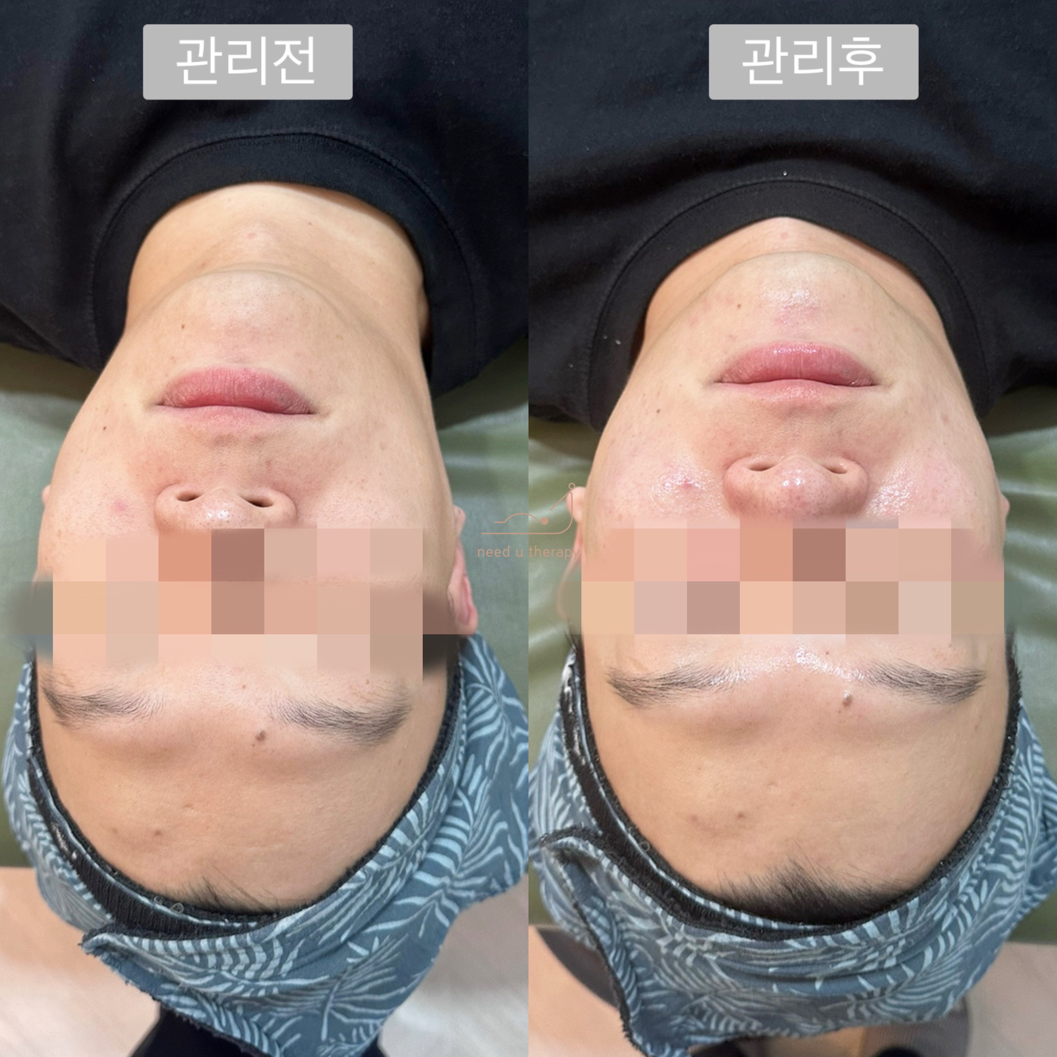 니쥬테라피
