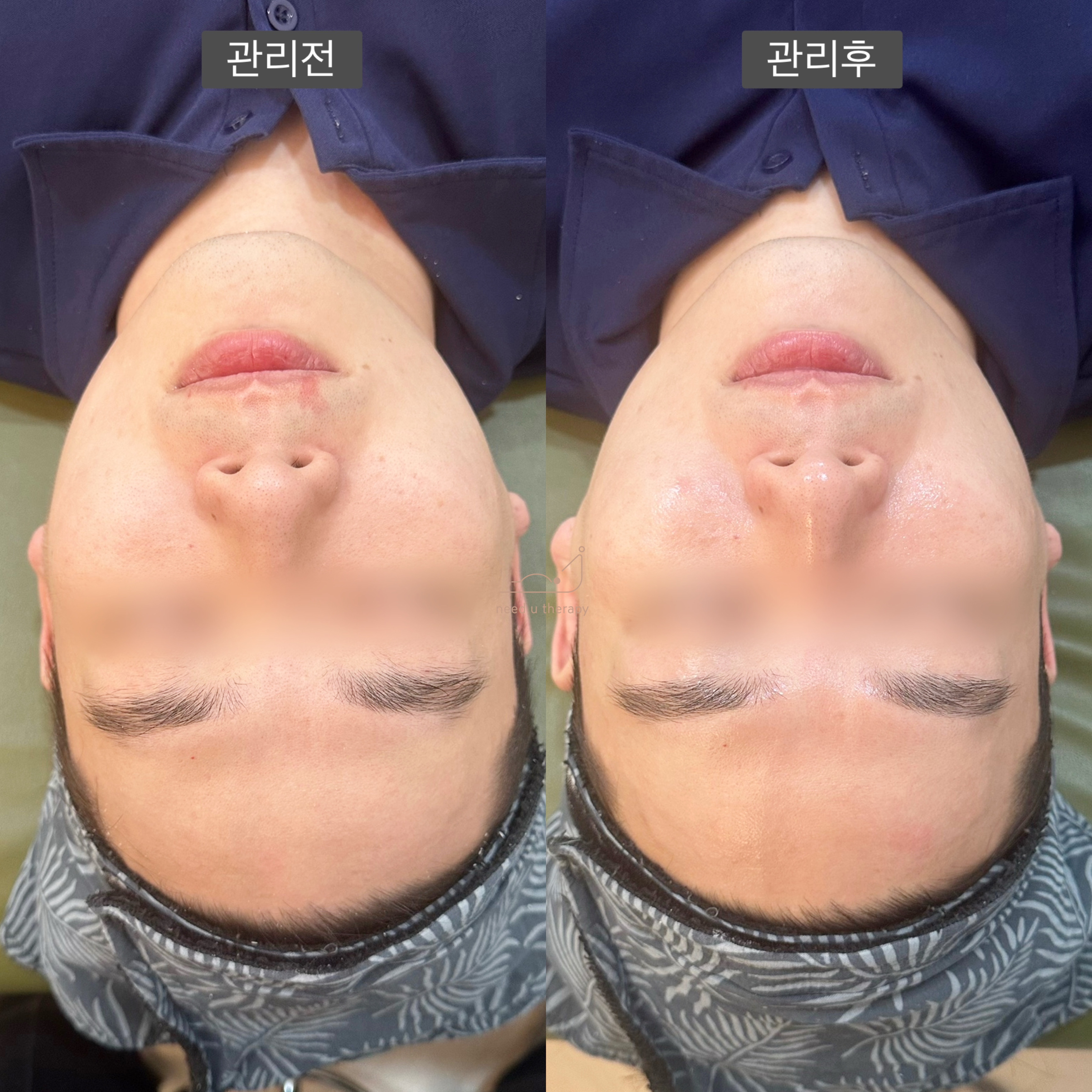 니쥬테라피