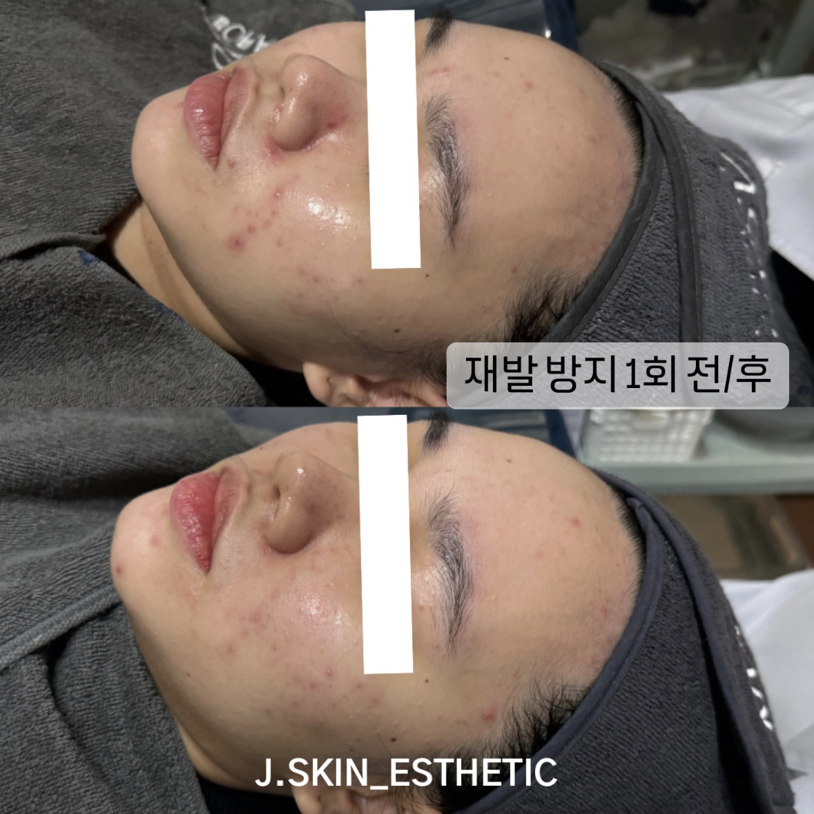 제이스킨