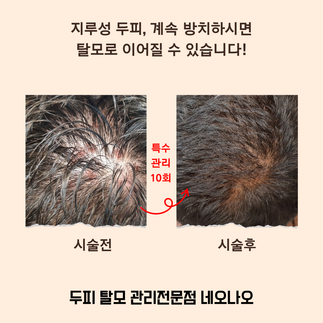 네오나오 대표 이미지