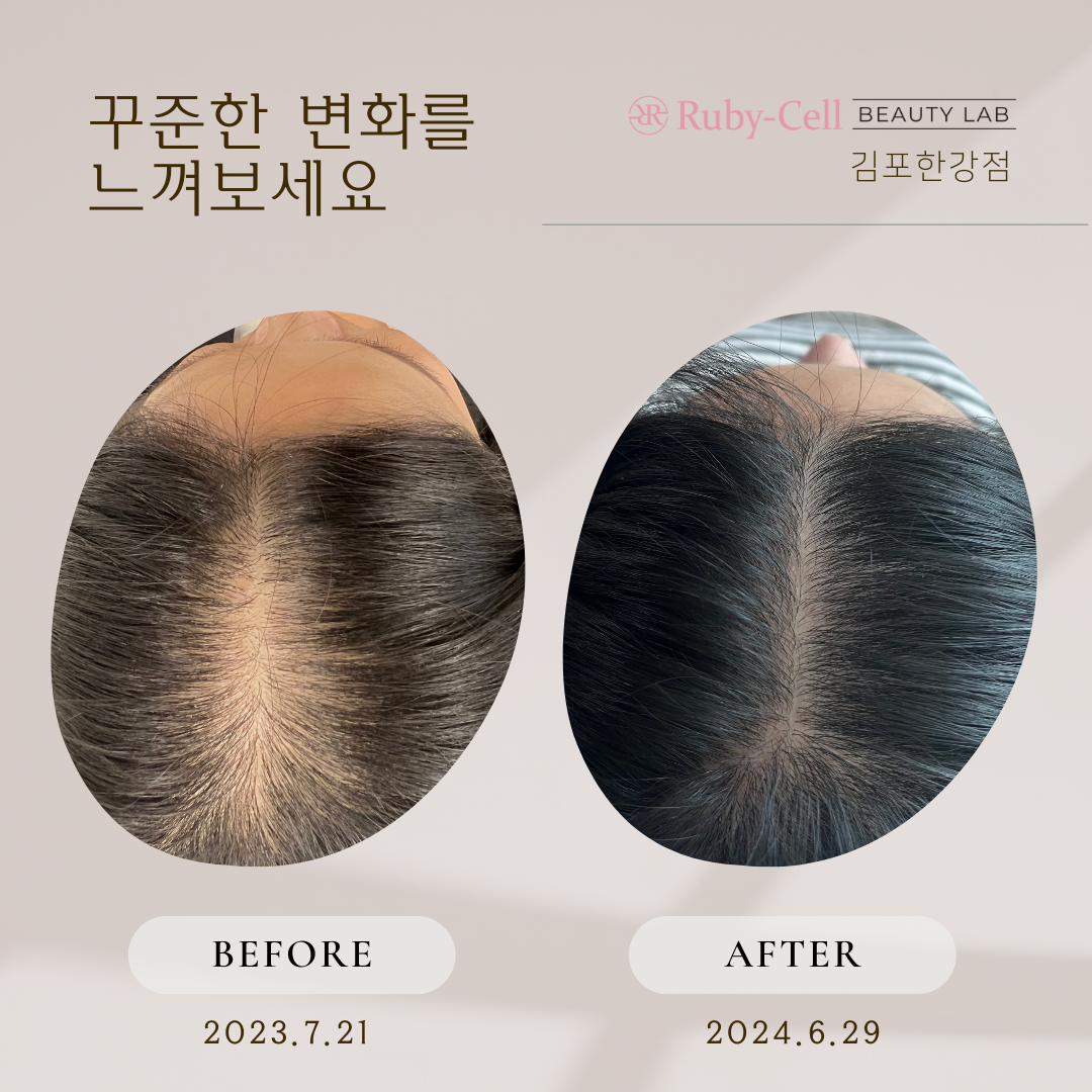 루비셀뷰티랩 김포한강점