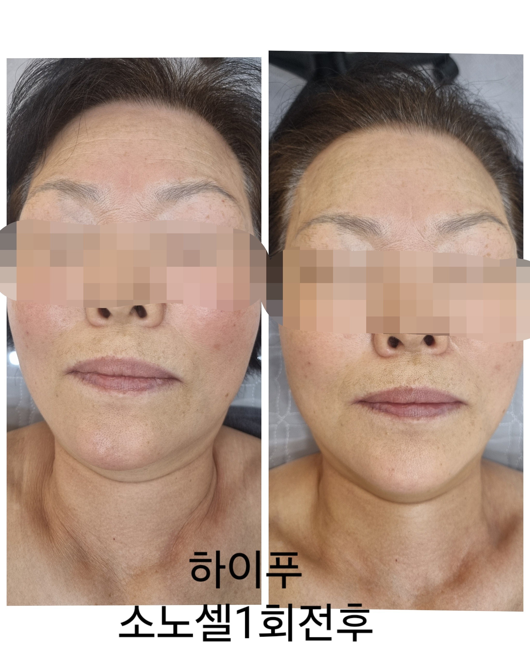 미드림 에스테틱 운정야당점 대표 이미지