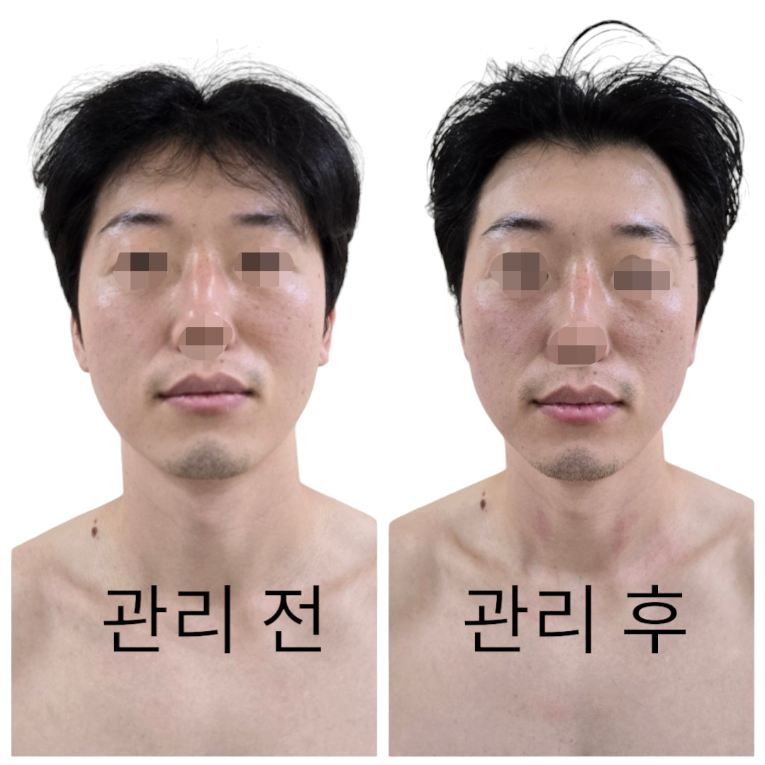 쑴숨쉬듯휴식하다&숲칼프