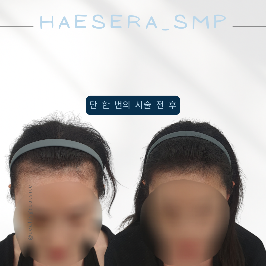 헤세라
