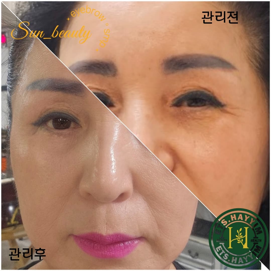 썬뷰티